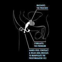 Anal Adventures  Prostrate Stimulator